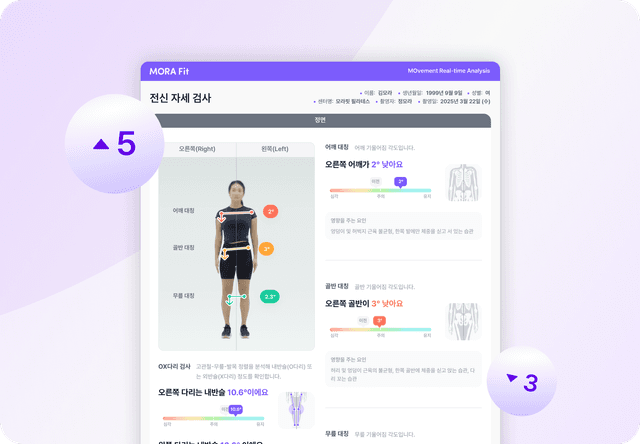 feature 2